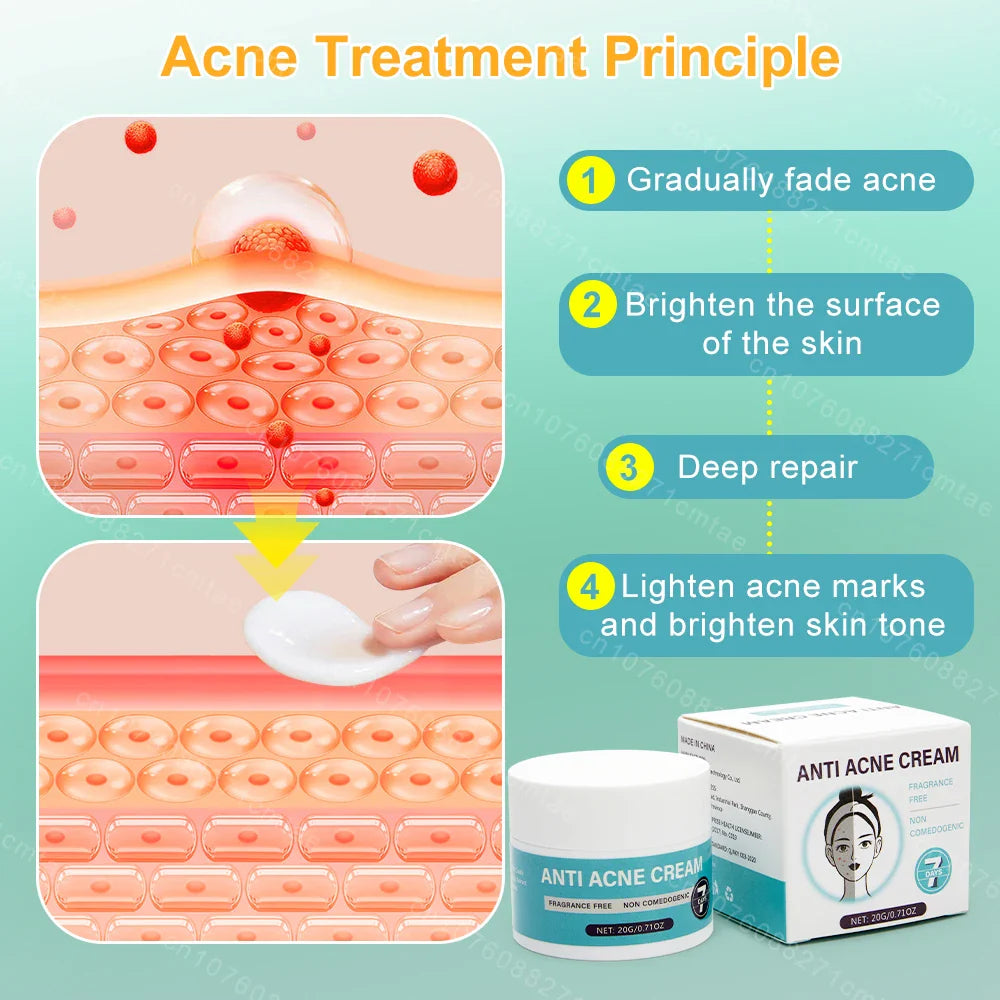 Acne Treatment Repair Acne Marks Deep Cleansing Shrink Pores Moisturizing Skin Care Products