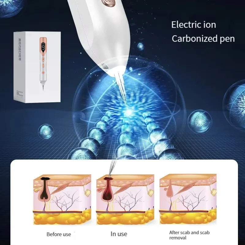 Laser Plasma Pen Laser Cosmetic Pen Home Beauty Rejuvenation Instrument Electric Microneedle Lonized Carbonization Technology