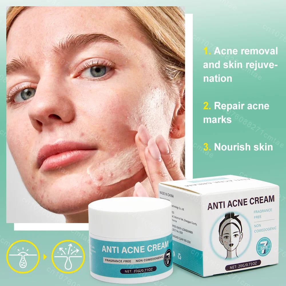 Acne Treatment Repair Acne Marks Deep Cleansing Shrink Pores Moisturizing Skin Care Products